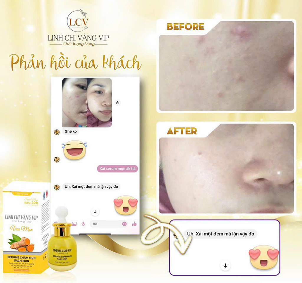 Serum Chấm Mụn Siêu Tốc 20H Linh Chi Vàng 30ml - Bí Quyết Đánh Bay Mụn Trong 20 Giờ