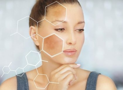 Bí quyết làm kem trị nám từ thiên nhiên tại nhà hiệu quả bất ngờ