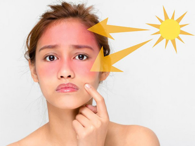 Bí Quyết Chăm Sóc Da Mùa Hè Với Kem Chống Nắng Hàn Quốc
